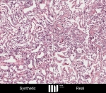 Zu sehen sind zwei rötlich gefärbte Gewebeschnitte mit blauen Zellkernen.